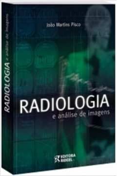 Radiologia e Análise de Imagens